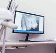 Dental x-rays on computer screen