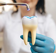 Woman in blue gloves demonstrating dental bonding on large model tooth