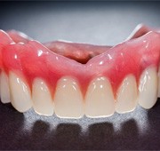 Full denture in Salem 