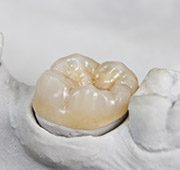 Model smile with dental crown restoration