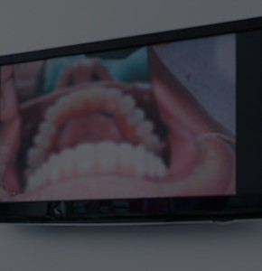 Intraoral photos on computer screen