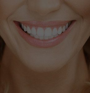 Closeup of flawless smile after cosmetic dentistry