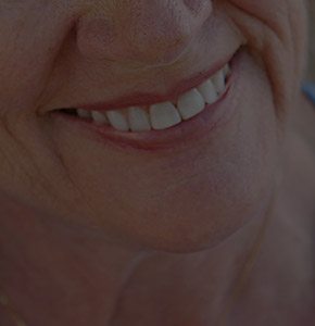 Closeup of healthy smile after restorative dentistry