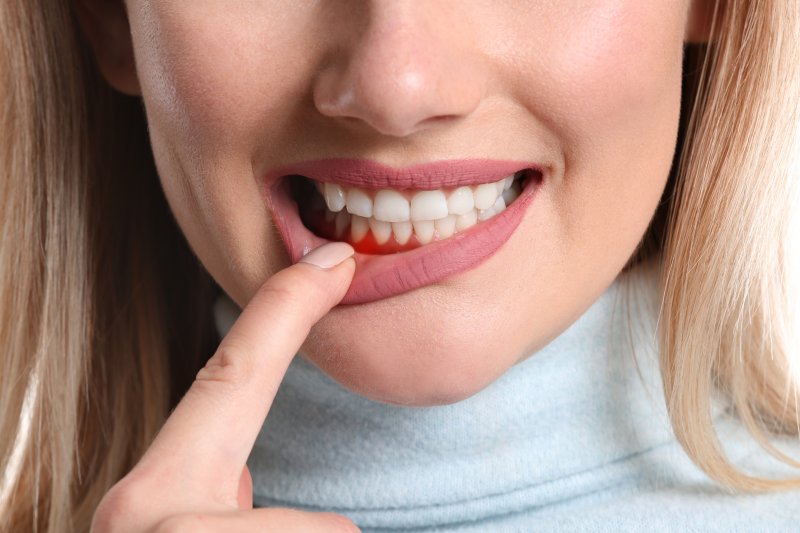 a woman pulling down her bottom lip to expose her red gums