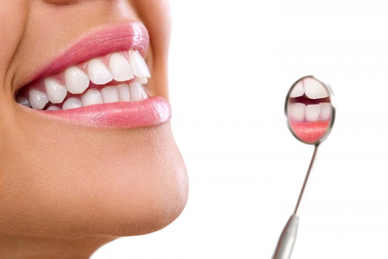 An up-close image of a woman’s smile and a dental mirror showing a reflection of her teeth