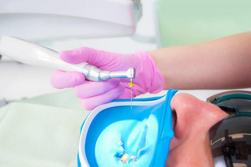 a patient undergoing a root canal